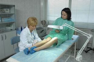 Laserska terapija proširenih vena na nogama