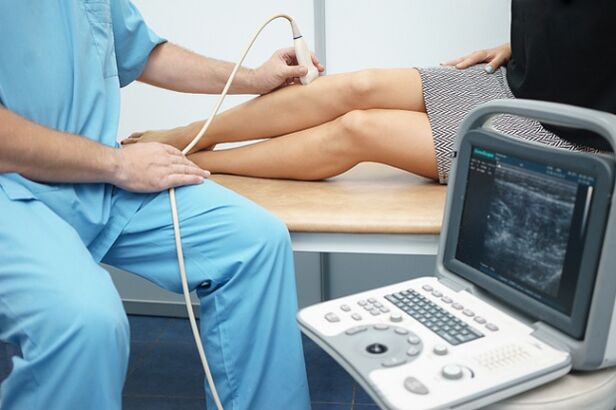 Dijagnostika otkrivanja retikularnih proširenih vena nogu ultrazvukom